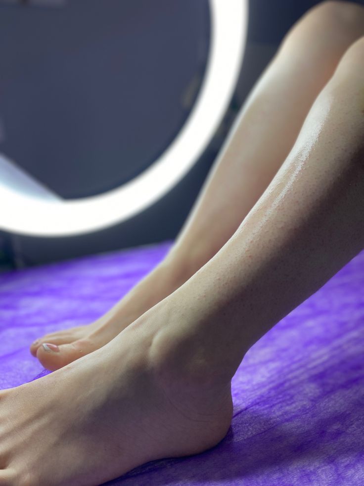 لیزر موهای زائد اصفهان