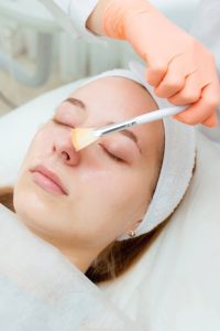 لایه برداری شیمیایی